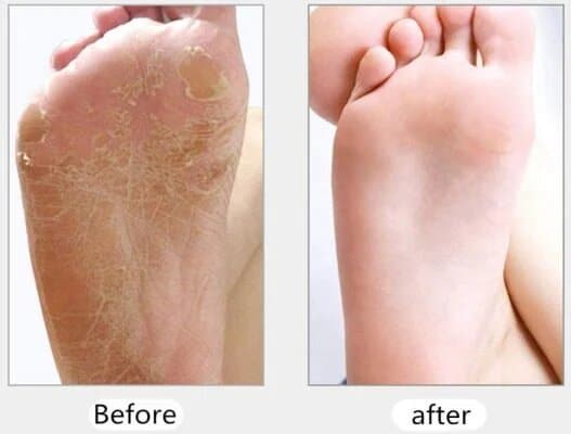 Electric Foot Grinder - Image 5