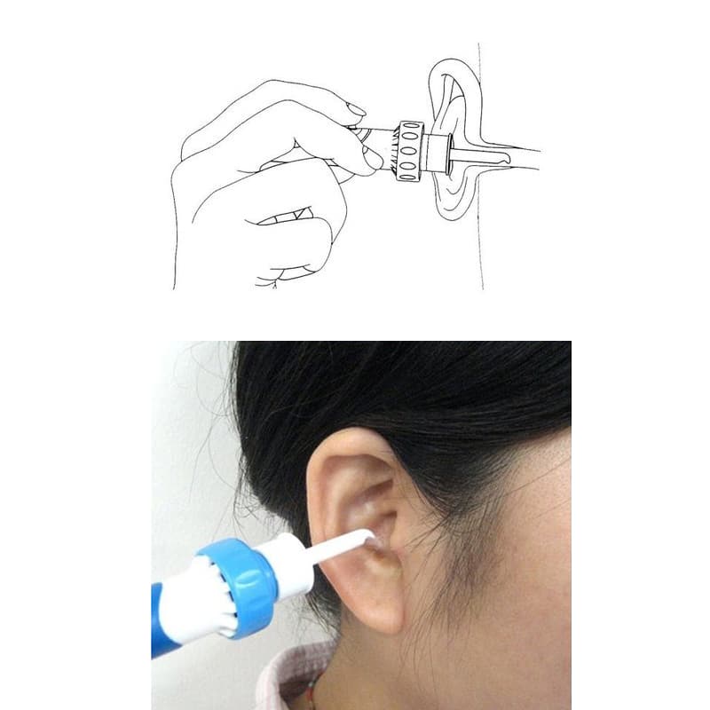 Ear Wax Vacuum - Image 2