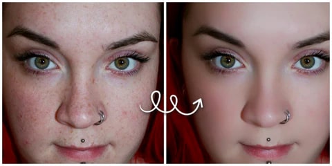Pro W Blemish Cream