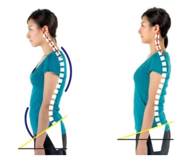 Invisible Back Posture Orthotics