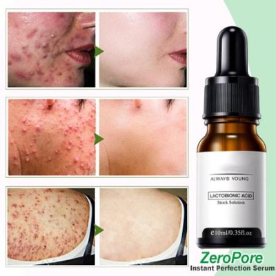 ZeroPore Instant Perfection Serum
