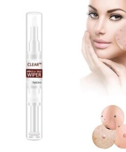 Clear Moles & Tag Wiper