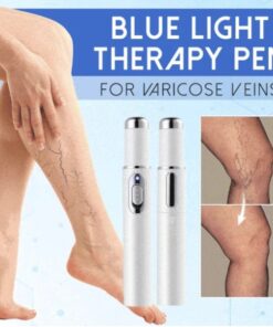 Blue Light Therapy Pen for Varicose Veins