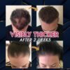Pure Grow Hair Growth Essence