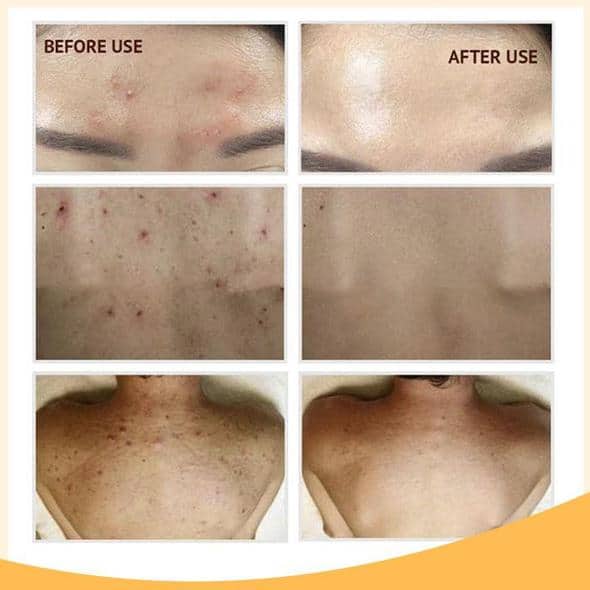 Retinol C+ Brightening Serum Set - Image 10