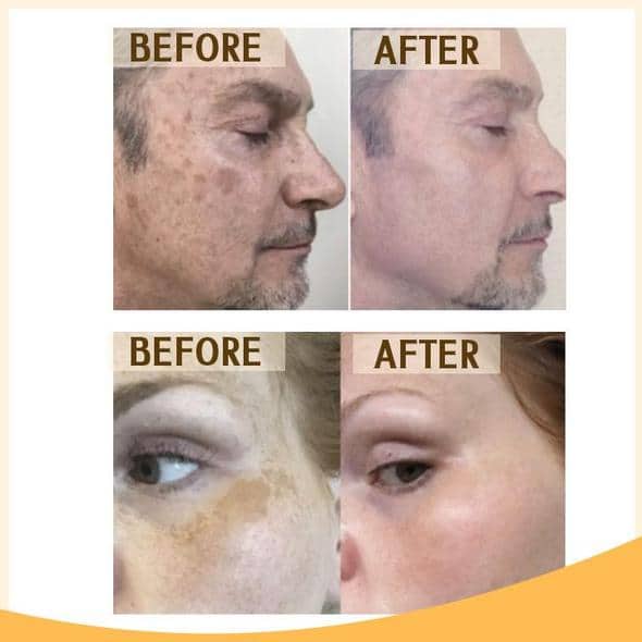 Retinol C+ Brightening Serum Set - Image 11