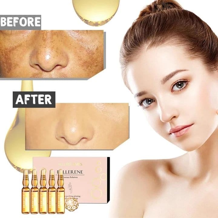 Whitening Spotless Ampoule Serum (Set of 7) - Image 2