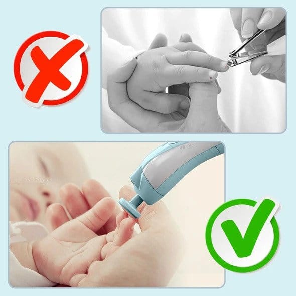 Electric Baby Nail Trimmer - Image 2
