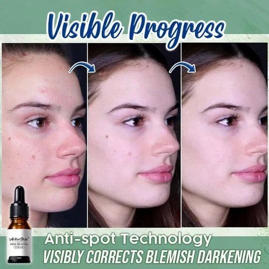 ActiveSkin Mole Removal Serum - Image 4