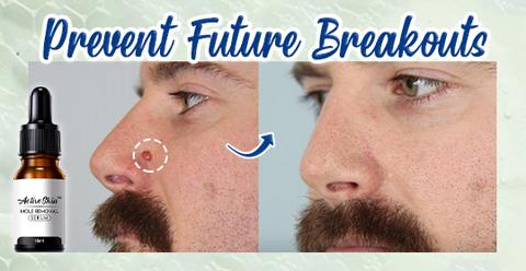 ActiveSkin Mole Removal Serum