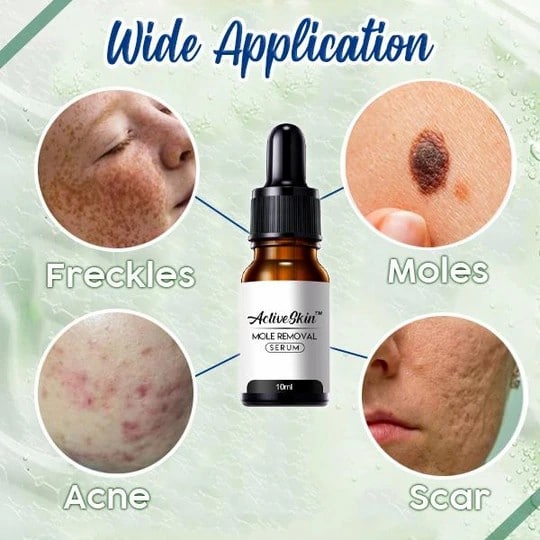 ActiveSkin Mole Removal Serum - Image 6