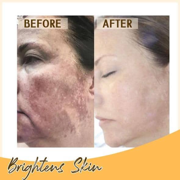 Retinol C+ Brightening Serum Set - Image 6