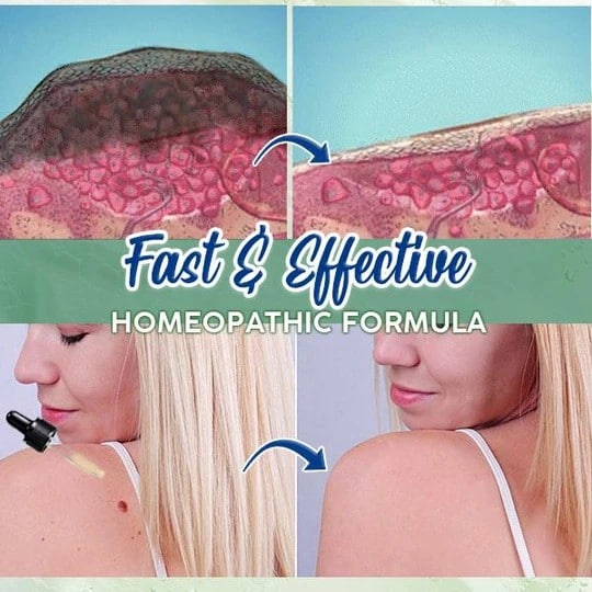 ActiveSkin Mole Removal Serum - Image 7