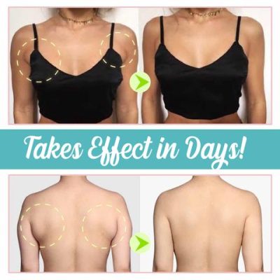 Sleevage Reduction Cream
