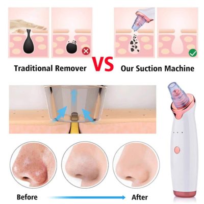 PoreCleanser Vacuum Pro