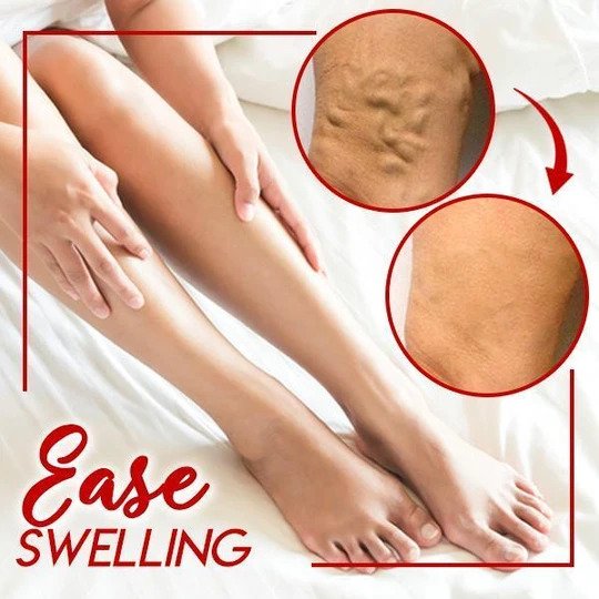 LegsRelief Calming Cream - Image 2