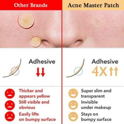 Fibroepithelial Polyp Removal Patch (36 pcs)