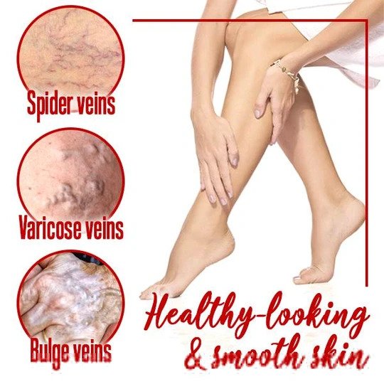 LegsRelief Calming Cream - Image 3