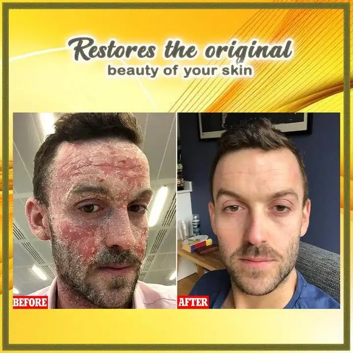 Herbal Skin Solutions Cream - Image 5