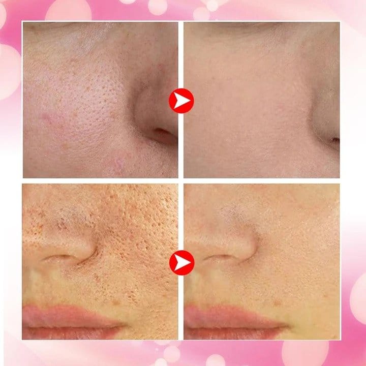 Porc Free Tightening Serum - Image 5