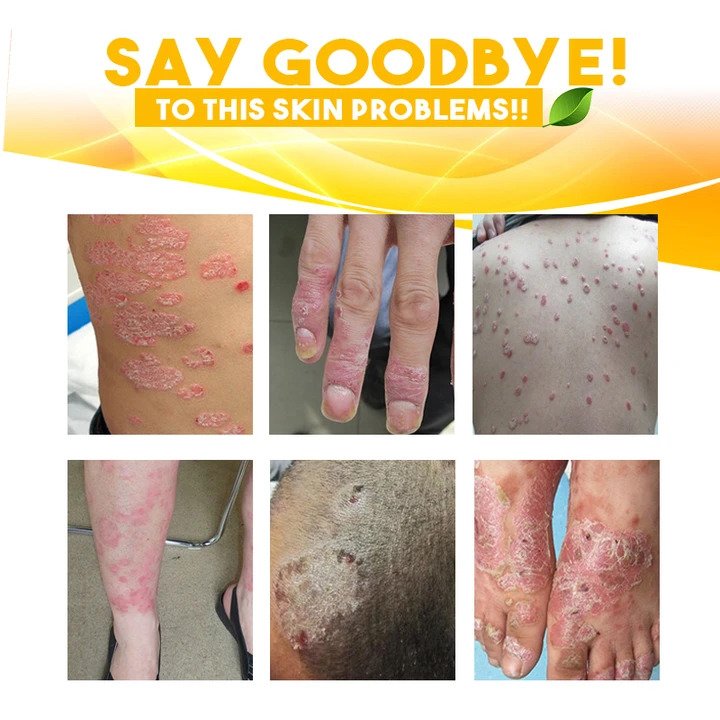 Herbal Skin Solutions Cream - Image 6