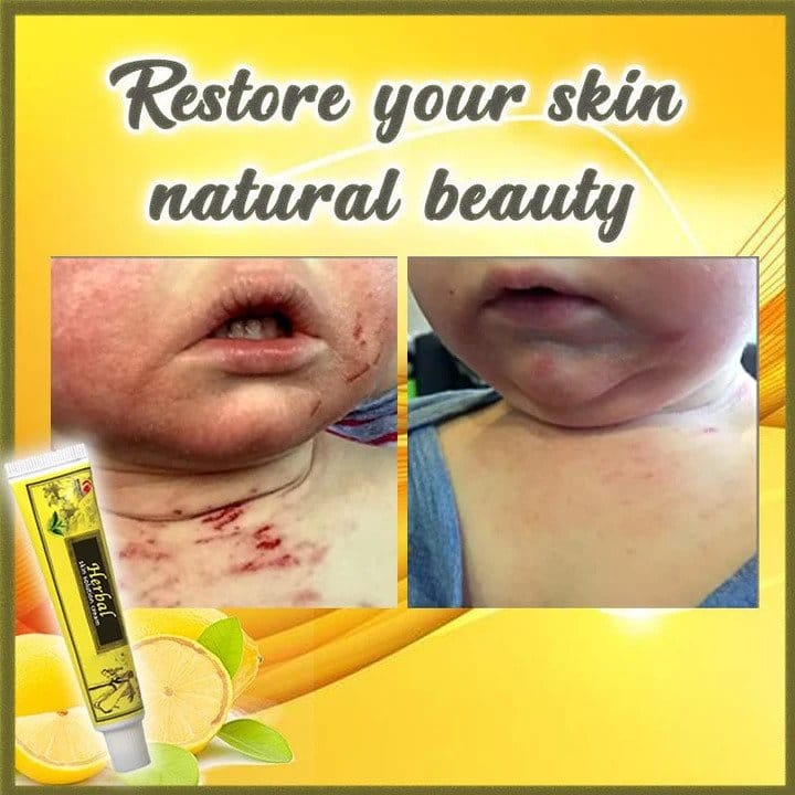 Herbal Skin Solutions Cream - Image 7