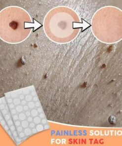 Fibroepithelial Polyp Removal Patch (36 pcs)