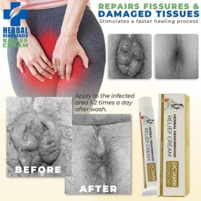 Hemorelief Hemorrhoids Treatment Ointment