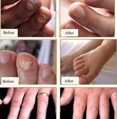 Dr PRO Anti-fungal Home Treatment Set