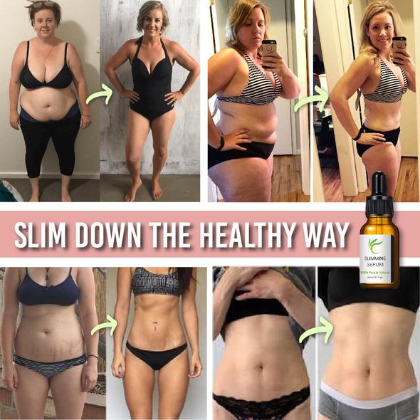 Tummy Tuck Belt with Fat Burn Serum - Image 6