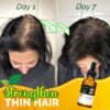 10X-Regro Strong Hair Serum
