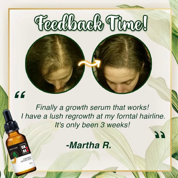 10X-Regro Strong Hair Serum - Image 10