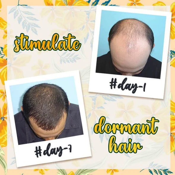 10X-Regro Strong Hair Serum - Image 7