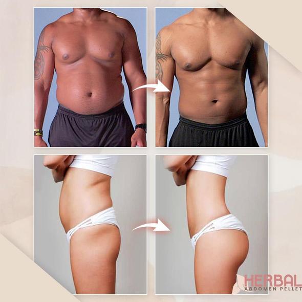Herbal Abdomen Pellet (10/30 Packs) - Image 2