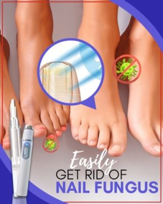 Fungal-out Blue Light Treatment Set,anti fungal nail treatment,best anti fungal nail treatment,strong anti fungal nail treatment,all natural anti fungal treatment