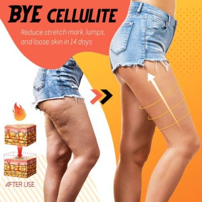 Fat Loss Spray,natural way to lose weight,Waist legs,weight loss,visibly reduces cellulite