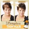 BaldFix Strong Hair Regrowth Serum (✨50%OFF)