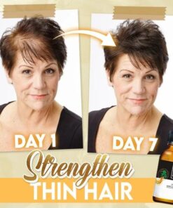 BaldFix Strong Hair Regrowth Serum (✨50%OFF)