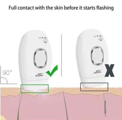 New Wave Professional Ipl Permanent Hair Removal,are all ipl treatments the same,i light laser hair removal,ipl facial hair removal,ipl intense pulsed light