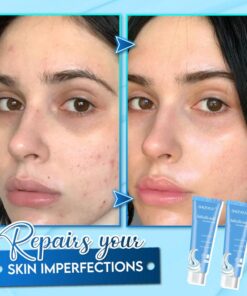 Salicylic Acid Ice Cream Mask