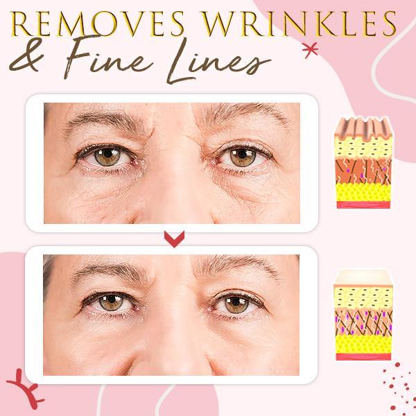 Snails Skin Care Eye Massage Cream - Image 2