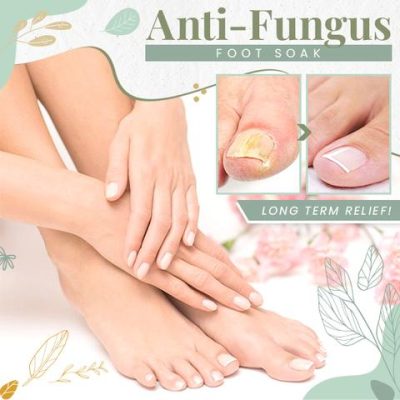 Anti-Fungal Peeling Foot Soak,Peeling Foot Soak,Foot Soak,Anti-Fungal Foot Soak,Anti-Fungal Peeling Soak