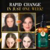 DR.Gro Anti-Hairloss Serum