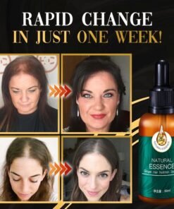 DR.Gro Anti-Hairloss Serum