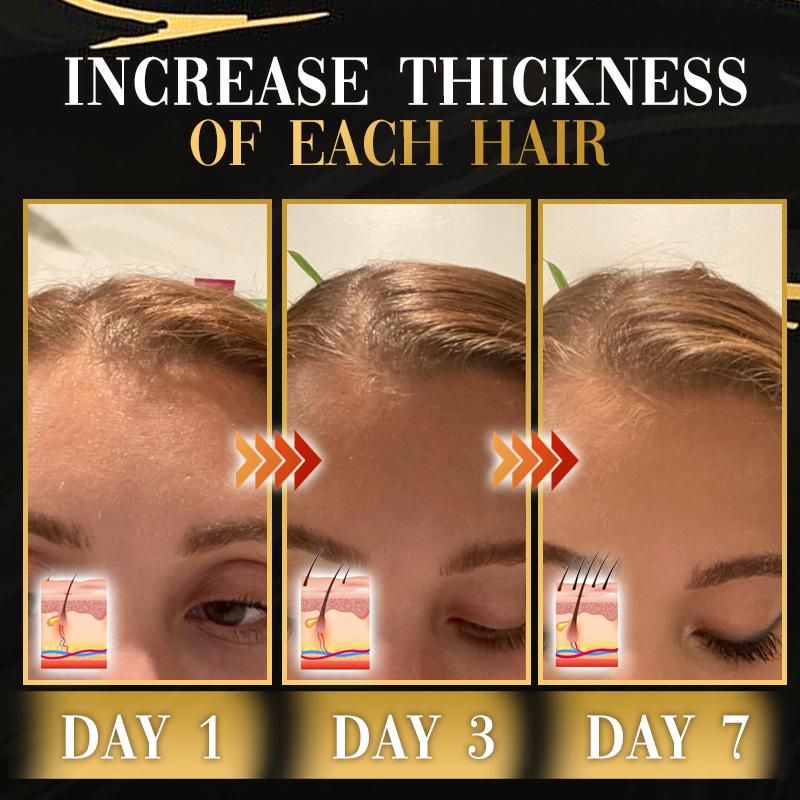 DR.Gro Anti-Hairloss Serum - Image 2