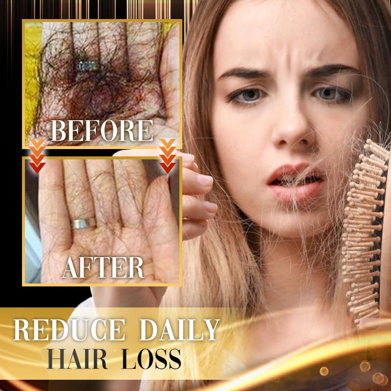 DR.Gro Anti-Hairloss Serum - Image 4