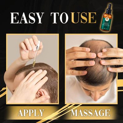 DR.Gro Anti-Hairloss Serum,DR.Gro Serum,Anti-Hairloss Serum