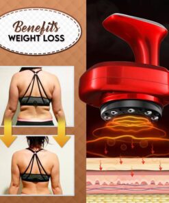 Electric Cupping Therapy Machine