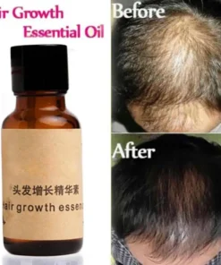 Organic Hair Growth Essence