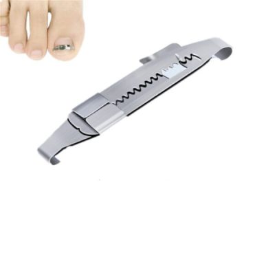 Toenails Correction Stainless Steel Clip Buckle,toenails,toenail growth,nails grow,abnormal nails